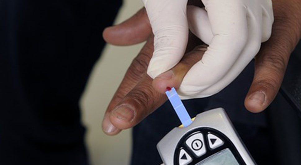 Проблем масне јетре не настаје од масне хране, већ од ових намирница