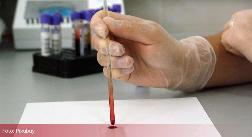 Проглашена глобална ванредна ситуација због вируса мајмунских богиња