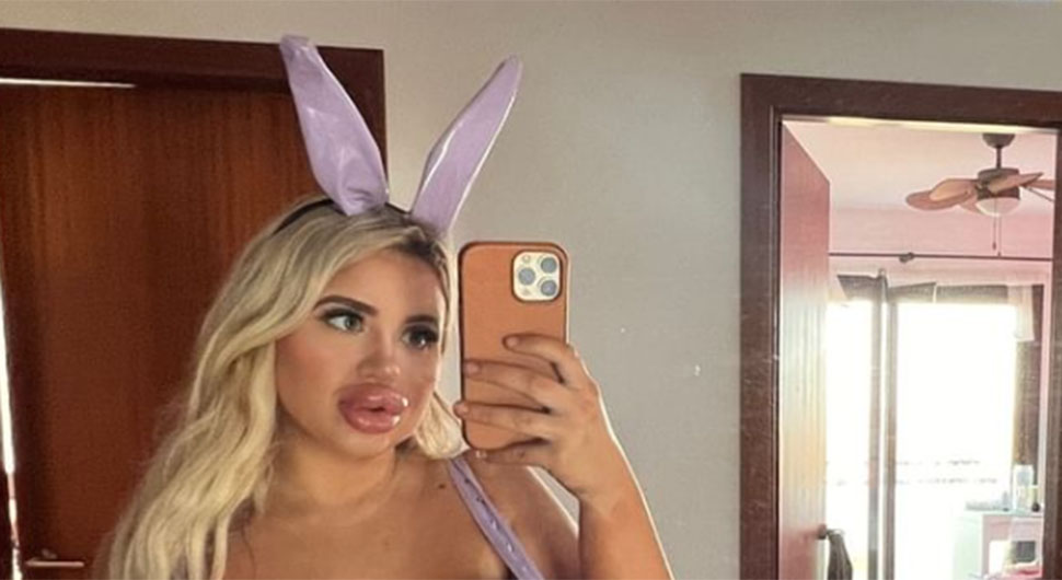 Ugradila ogromne silikone pa se snimala kako trči