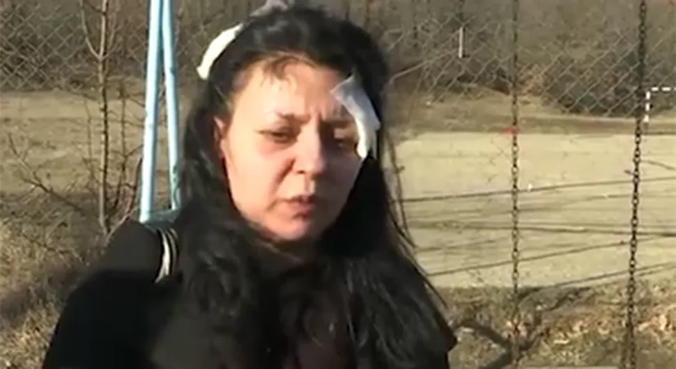 Žena koju su izujedali stafordi ispričala kako se incident dogodio