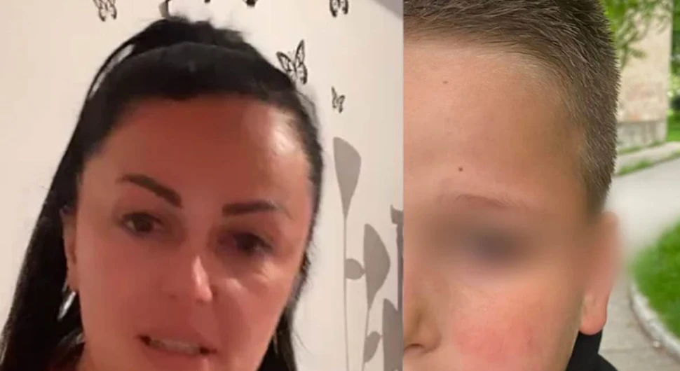 Oglasila se majka povrijeđenog dječaka (9): Kroz suze ispričala kako je njen sin pretučen!