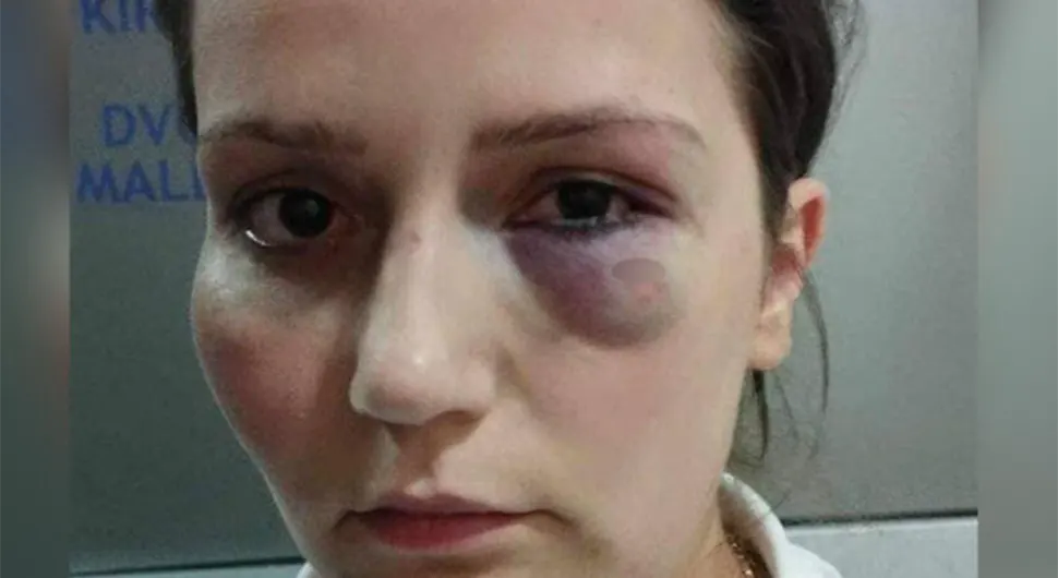 Za danas najavljeni protesti zbog radnice koju je pretukao vlasnik hotela