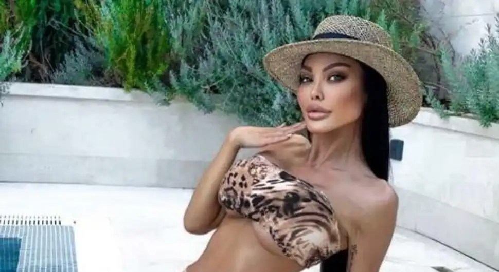 Маја Маринковић објавила слике: Тврди да је претучена!