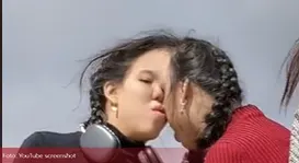 Сијамске близнакиње већ 15 година живе са спојеним лобањама