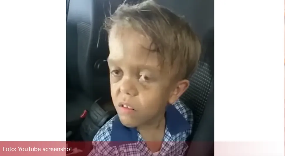 Дјечак патуљастог раста је хтио да се убије због малтретирања вршњака, а сада игра у холивудској серији