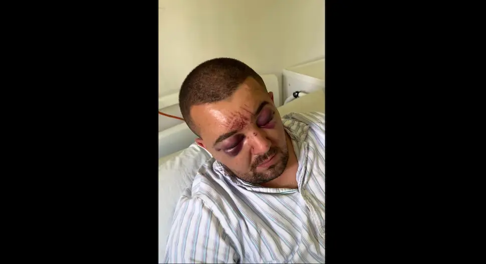 Идентификовани осумњичени за премлаћивање Младена Дроце