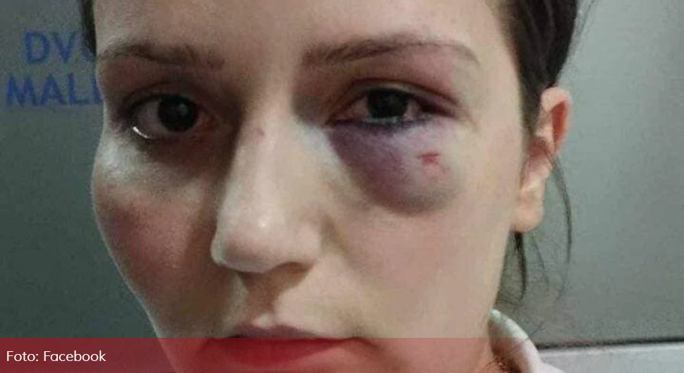 Власник хотела Јабланица поново осуђен: Тукао је јер му је дала отказ