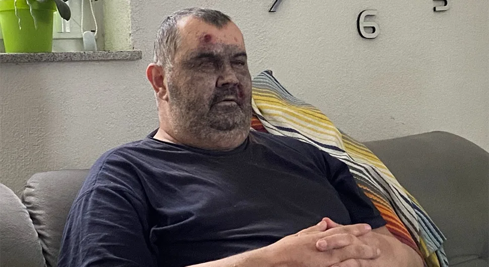 Повријеђен у експлозији у руднику: Шимуну треба наша помоћ