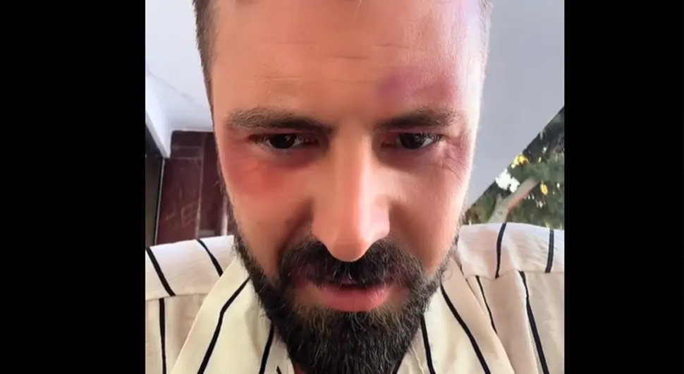 Пјевач сав у модрицама, тврди да је претучен: ''Није ми добро, треба ми помоћ''