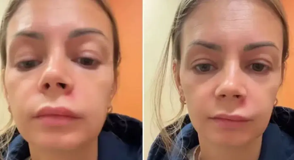 Доживјела парализу лица због нечега што сви раде