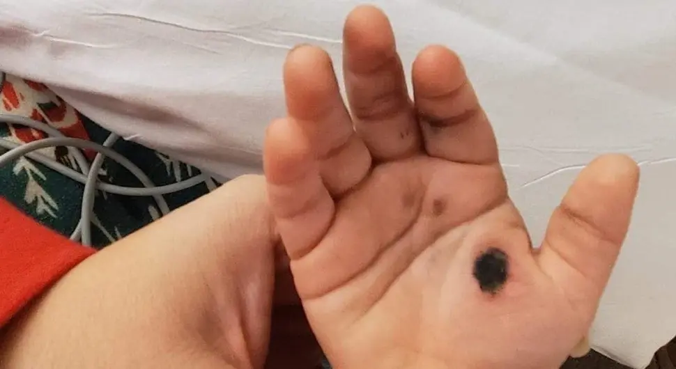 Беба замало настрадала због пуњача за телефон: Мајка послала упозорење родитељима