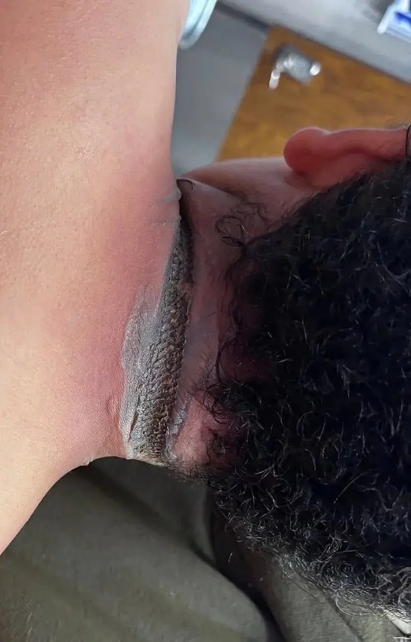 Опекотине од пуњача