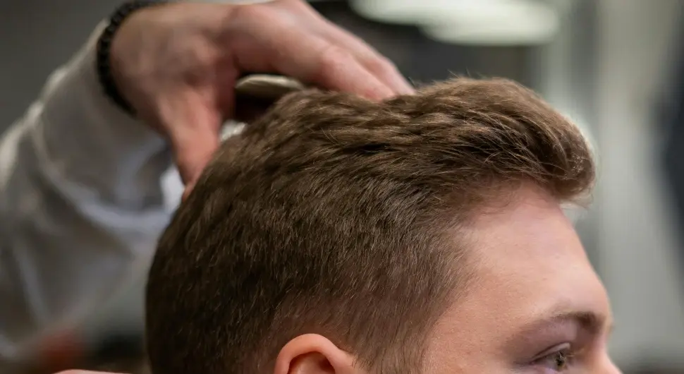 Мушкарац (36) умро након пресађивања косе на клиници у Турској!