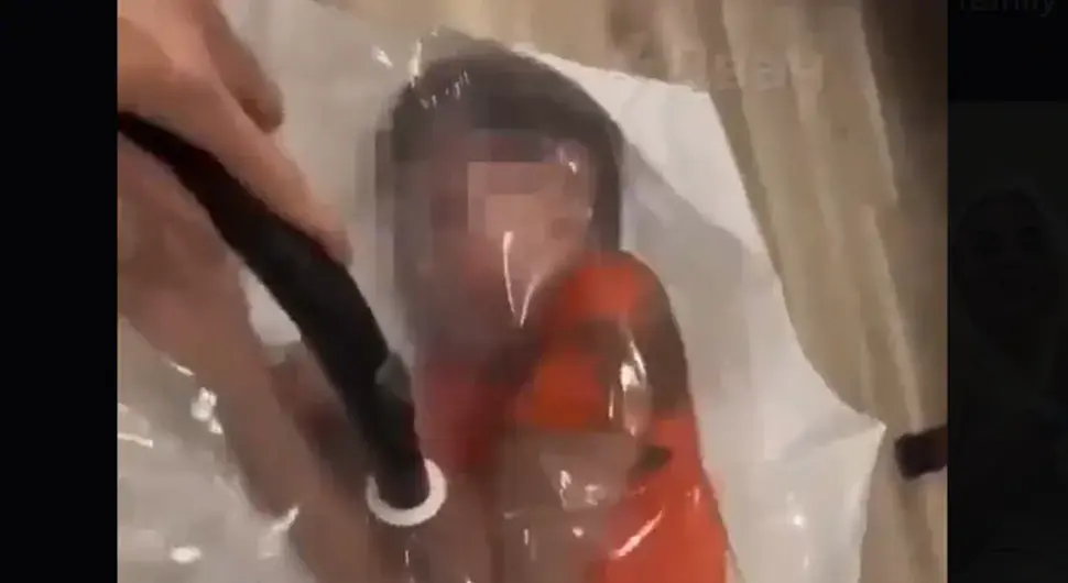 Мајка ставила сина у вакуум кесу-08122025