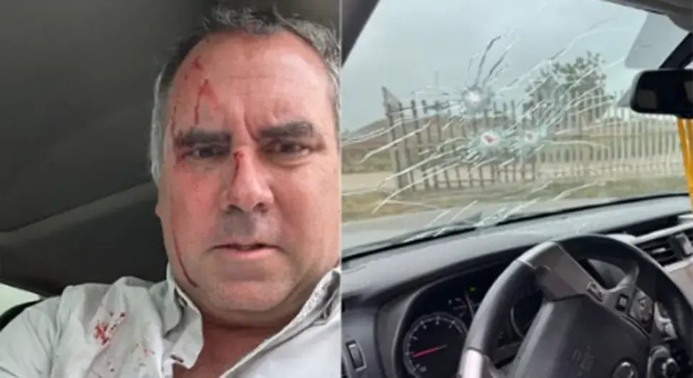 Атентат на предсједничког кандидата, нападачи испалили 3 метка!