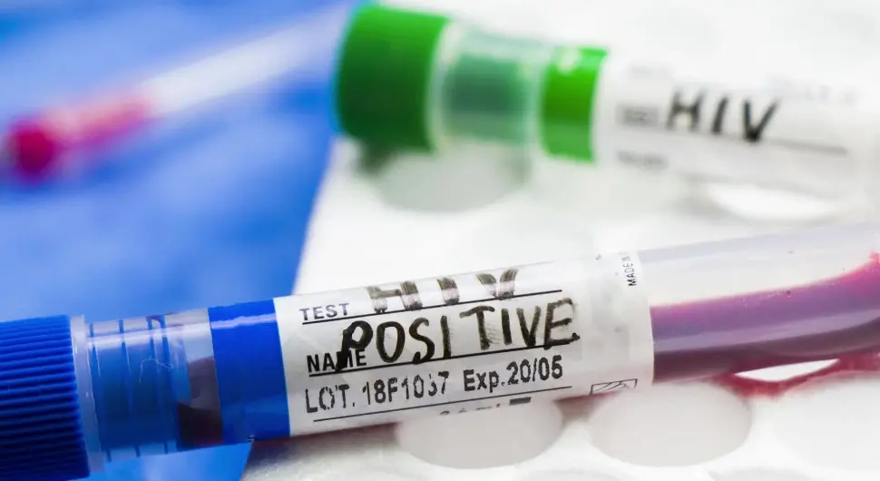 Обиљежен Свјетски дан борбе против ХИВ-а