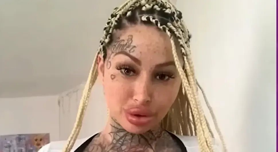 Преминула "краљица" пластичних операција