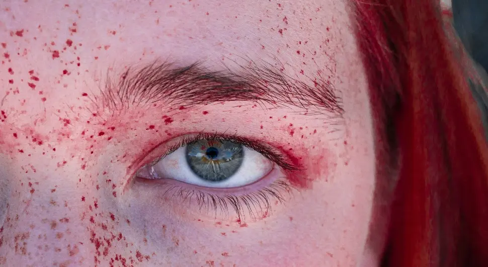 Тихи узрочник алергија: Никл се крије у омиљеном накиту и храни коју једете