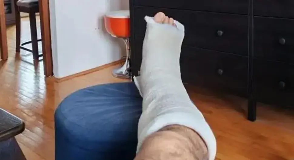 "Пуче ко леденица": Познати музичар доживо тежак прелом ноге на паркингу