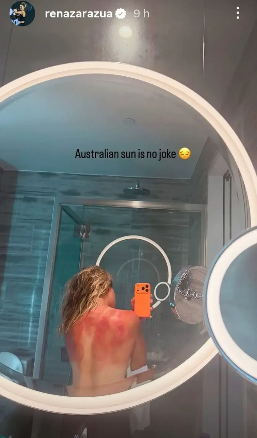 Аустралијско сунце није шала