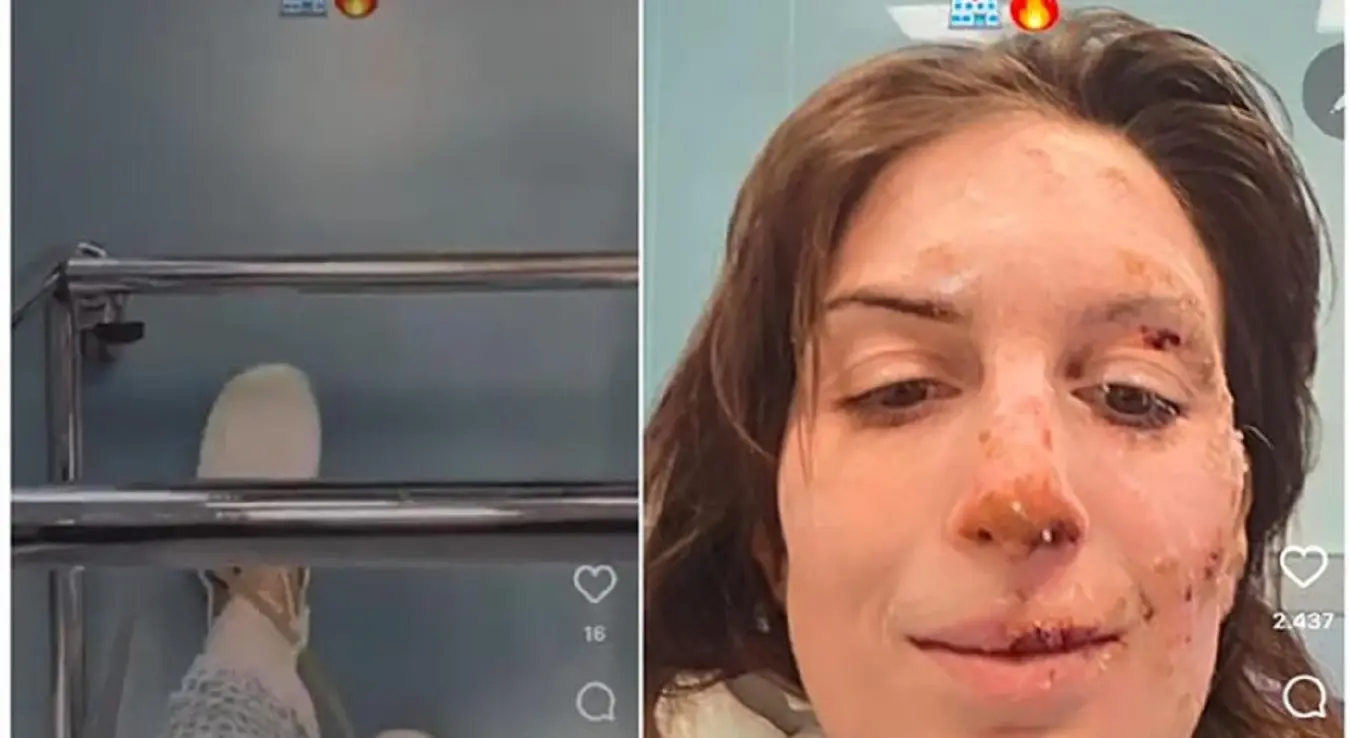 Елеонора је преживјела пожар у швајцарском бару, објавила слике из болнице