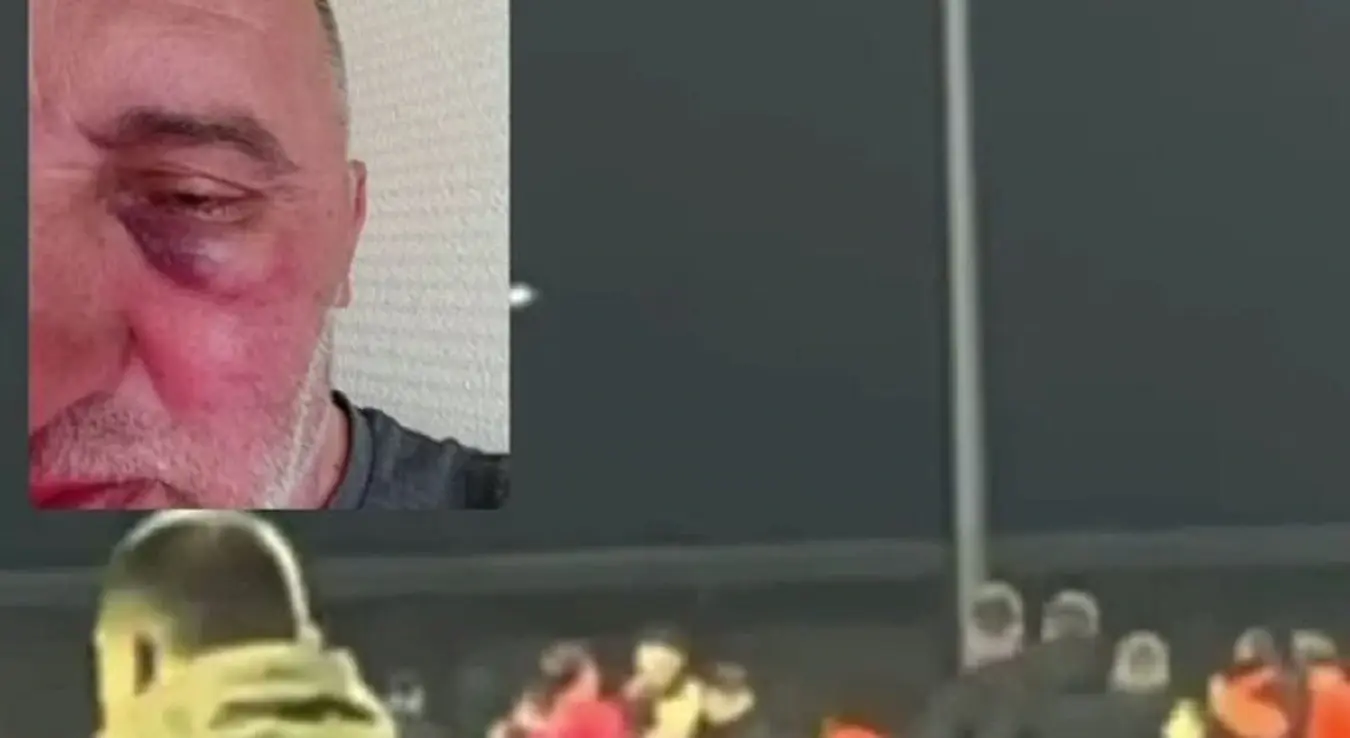 Огласила се и Слога: Раде Шешлак физички нападнут и ударен од играча Жељезничара