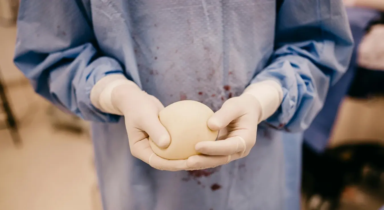 Увећање груди без резова: Доктор Ненад Степић објаснио нову методу