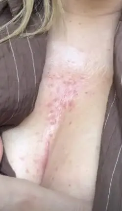 Нивес Целзијус