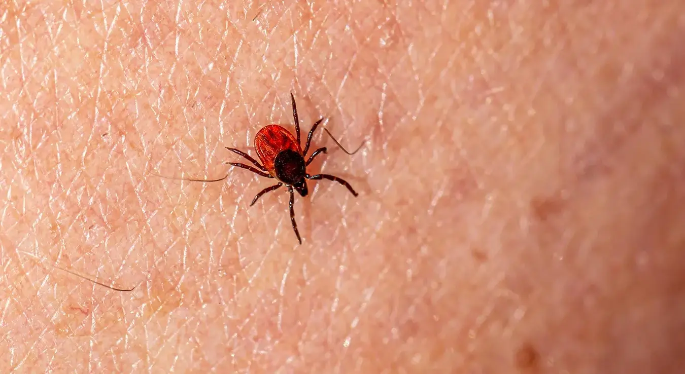 Црвени крпељ на људској кожи.