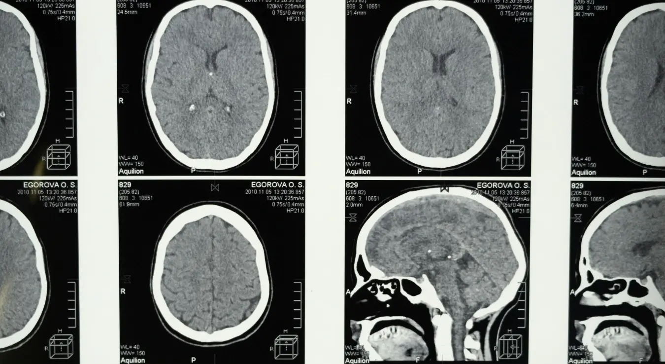 Мозак снимак мозга