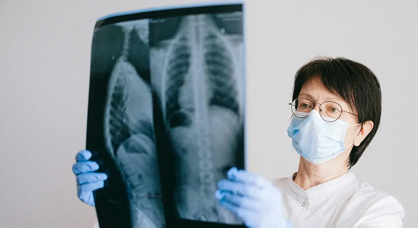 плућа-снимак плућа