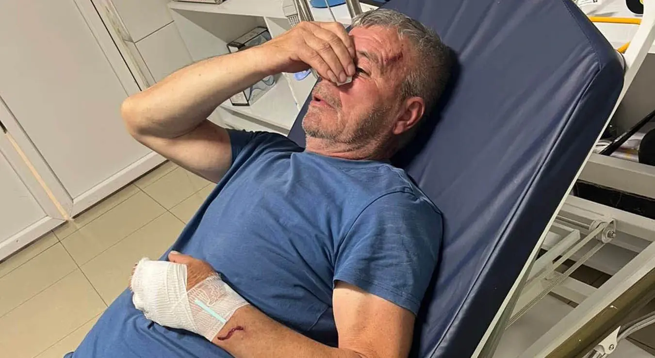 Свето Илић повријеђен у болници