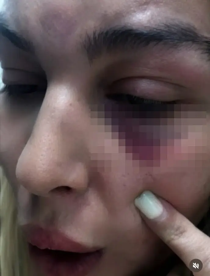 Претучена Ава Карабатић
